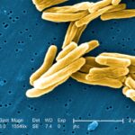 Activan alerta por 8 casos de tuberculosis en Tampico